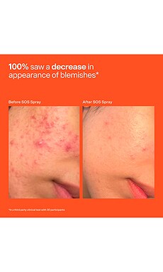 Tower 28 SOS Stressed Skin Starter Set - vista 7