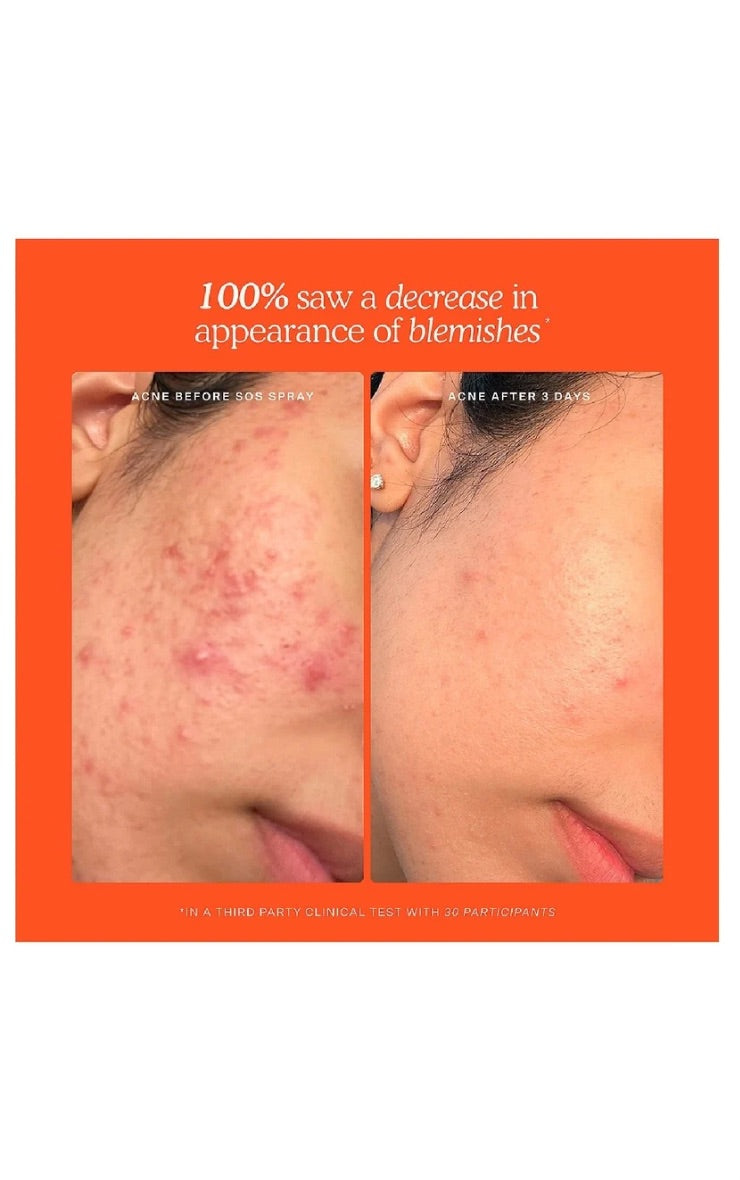 Set SOS 3-Step para Piel Sensible Mi tienda