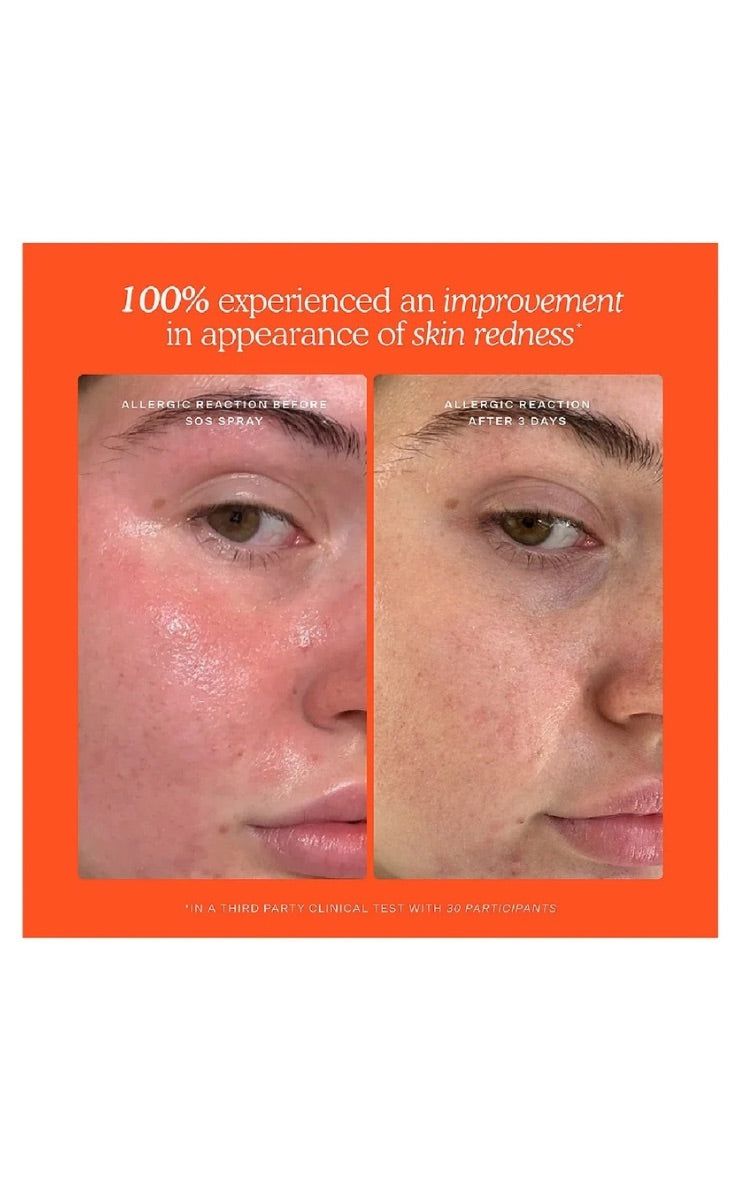 Set SOS 3-Step para Piel Sensible Mi tienda